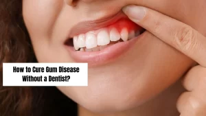 How-to-Cure-Gum-Disease-Without-a-Dentist